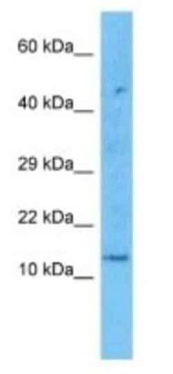 KRTAP2-1 Rabbit anti-Human, Polyclonal, Novus Biologicals 100 &mu;g; Unconjugated:Antibodies,